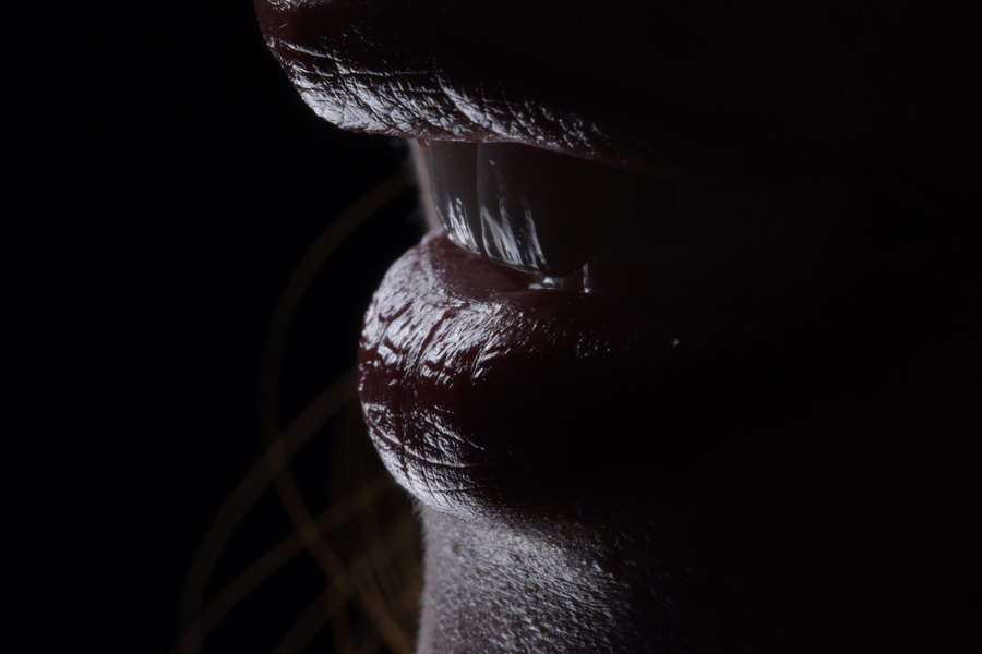 Profil des lèvres et des dents après réhabilitation globale par facettes (patient du cabinet)