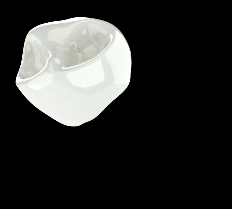 Onlay en céramique (animation du cabinet)